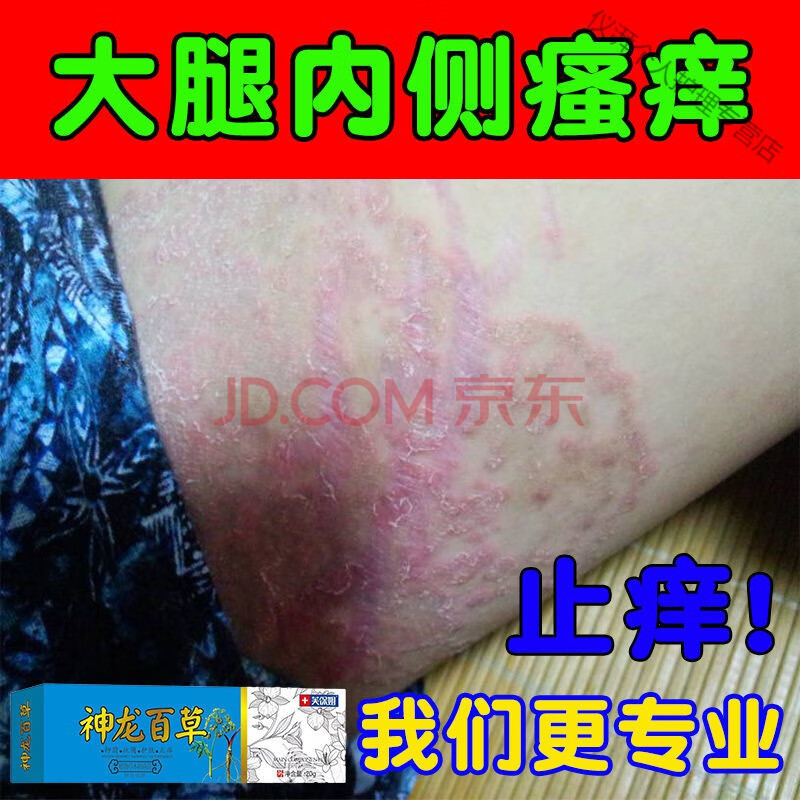 屁股上有疙瘩久坐屁股上长痘痘屁股痒屁股疮屁股湿l疹杀菌止痒 1盒