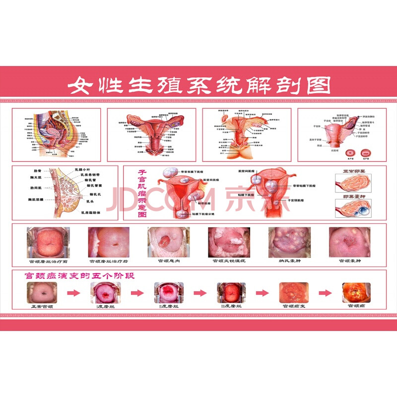 女性生殖器解剖图 医院宣传挂图子宫 妇科海报宫颈疾病示意图 女性