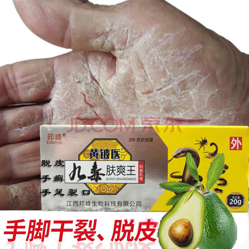 汗疱疹外用药治疗手癣膏鹅掌风真菌感染皮肤用药干裂水泡湿疹藓汗疱疹