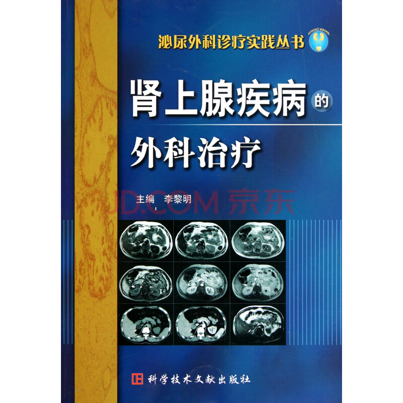 肾上腺疾病的外科治疗\/泌尿外科诊疗实践丛书