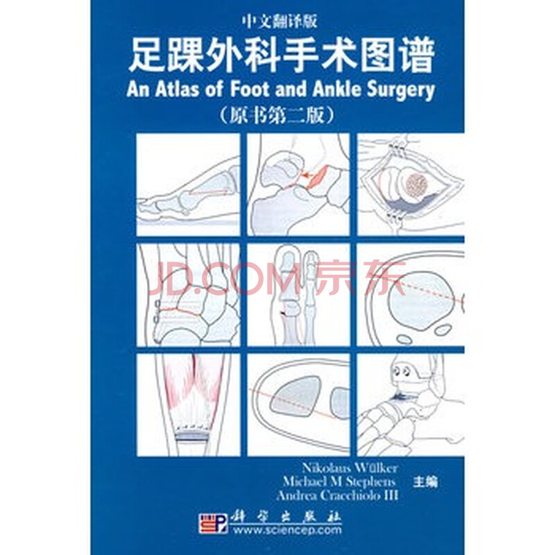 足踝外科手术图谱图片