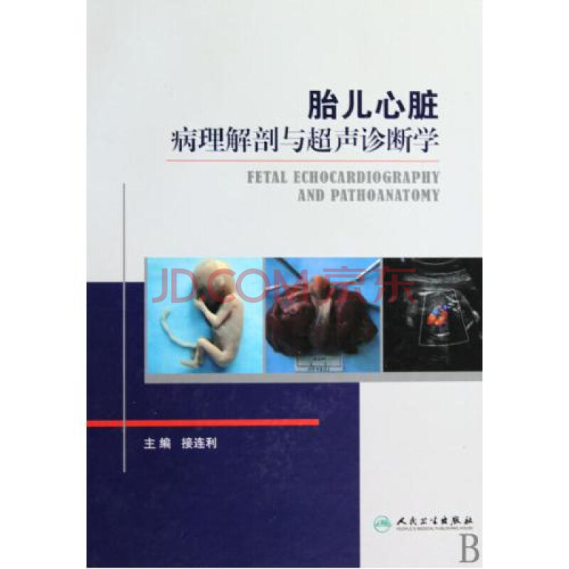 胎儿心脏病理解剖与超声诊断学(精)图片