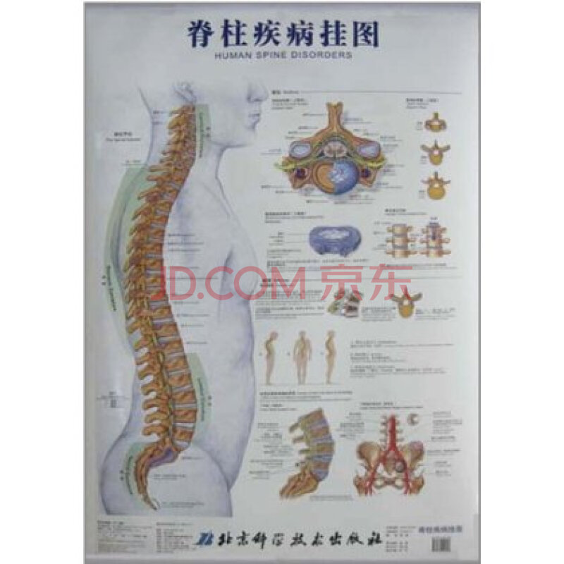 脊柱疾病挂图(新版) Anatomical Chart Compan