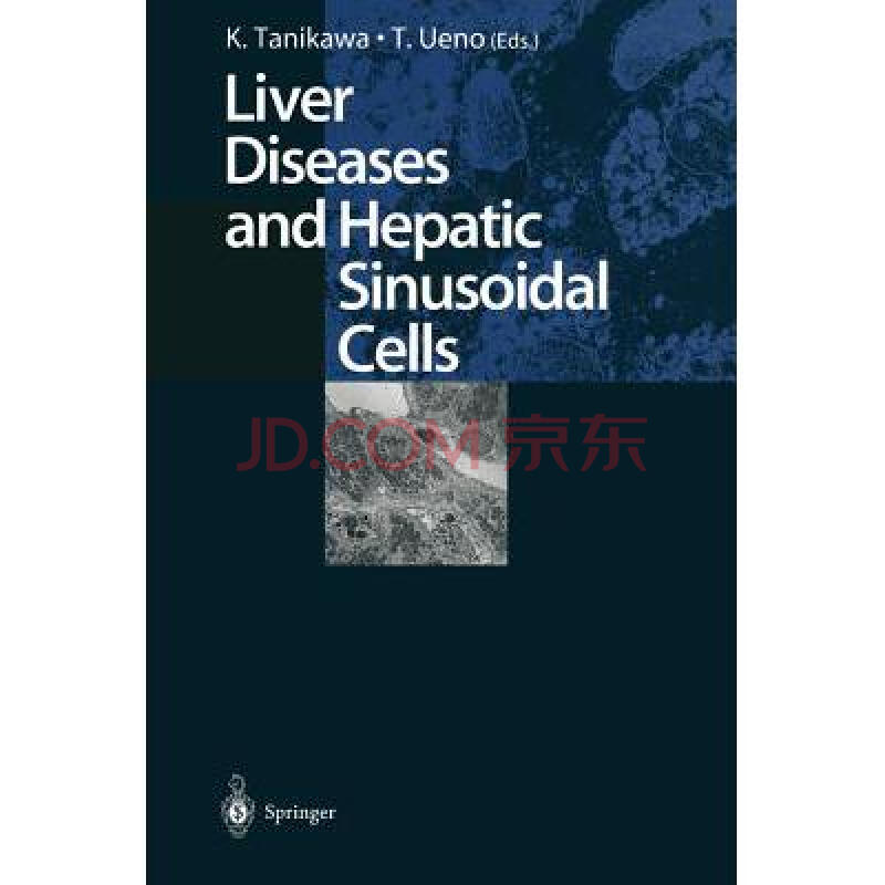 liver diseases and hepatic sinusoidal cells