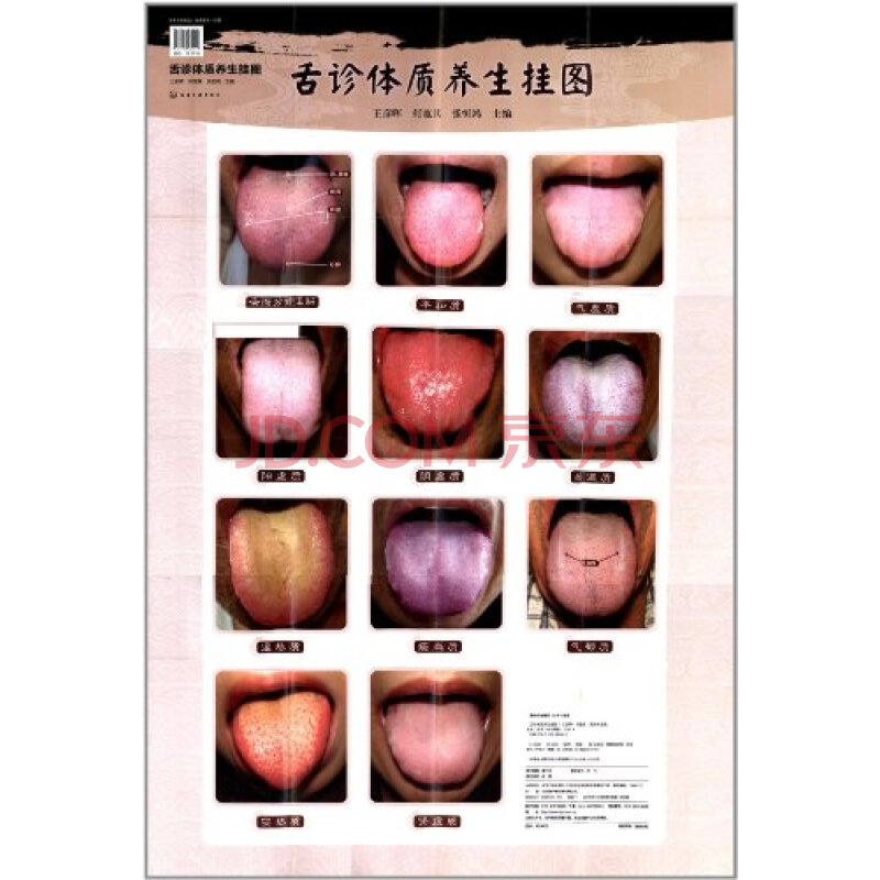 舌诊体质养生挂图图片