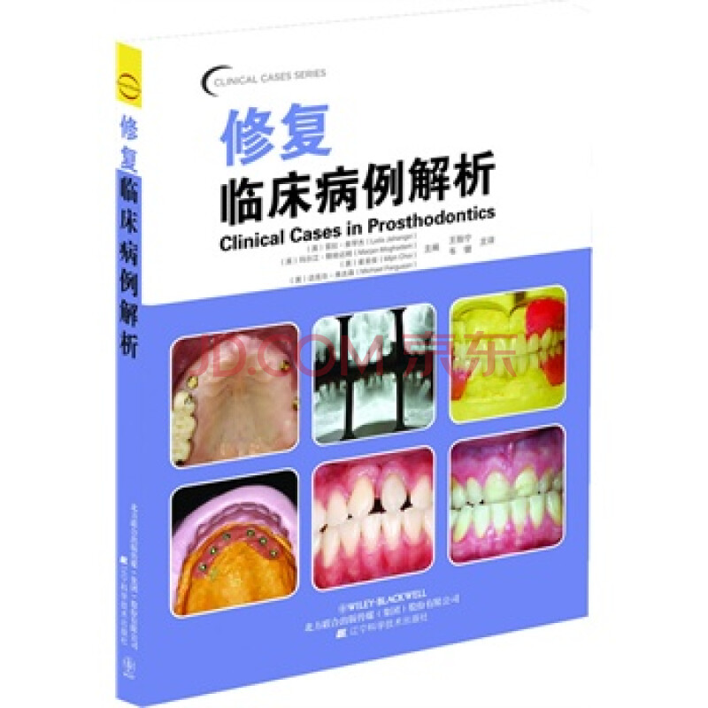 修复临床病例解析(口腔临床病例解析丛书)图片