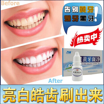 牙齿美白 牙斑净10ml 去除剔牙渍烟斑茶垢黑黄