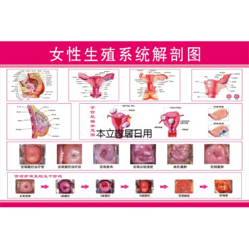 医院宣传挂图子宫 妇科海报宫颈疾病示意图 女性生殖系统解剖图 pp胶