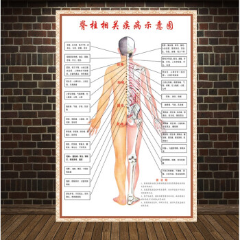 新品脊柱相关疾病示意图中医养生病理原因结构图挂图海报脊柱相关疾病