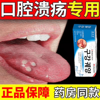 口腔溃疡溃烂复发性治口疮烂舌头嘴巴口舌生疮上火起泡烂嘴巴 一盒装