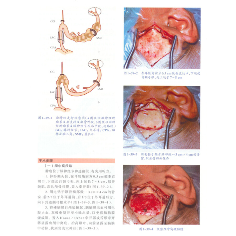 耳鼻咽喉头颈外科手术彩色图解(附光盘)/"十二五"国