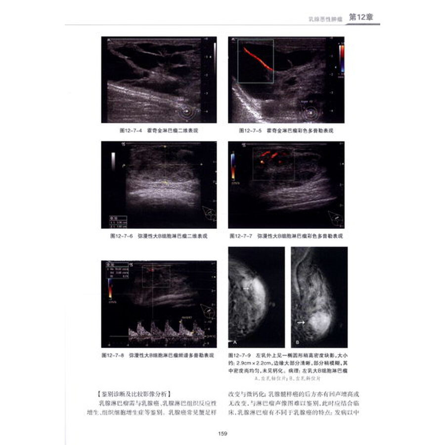 乳腺超声诊断学