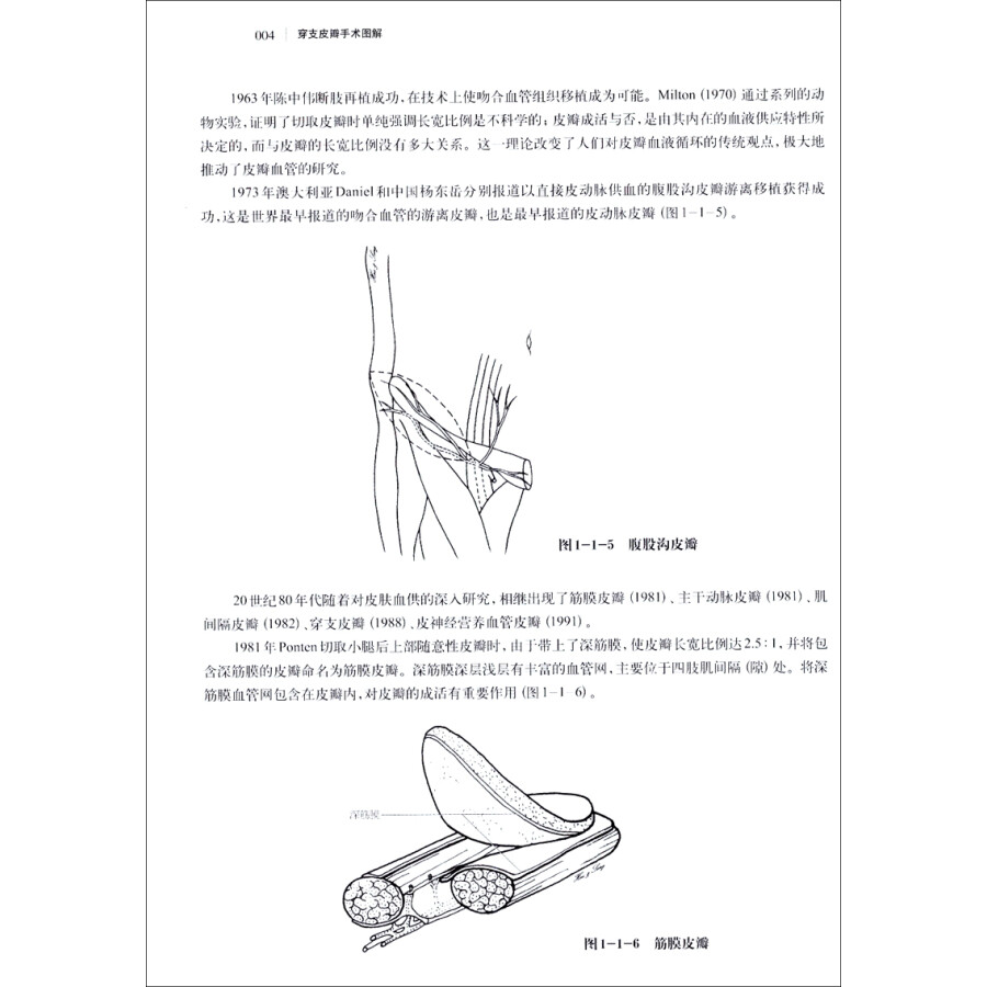 穿支皮瓣手术图解