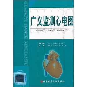 广义监测心电图