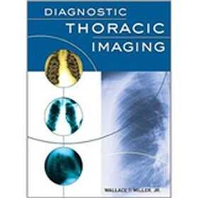 Diagnostic Thoracic Imaging