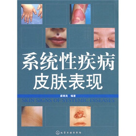 系统性疾病皮肤表现