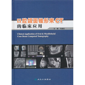 口腔颌面锥形束CT的临床应用