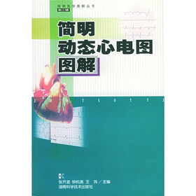 简明动态心电图图解