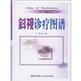 斜视诊疗图谱