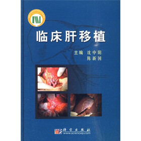临床肝移植