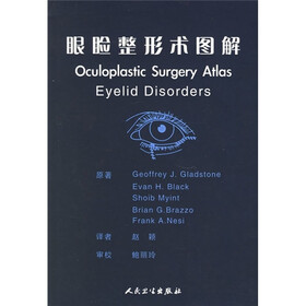 眼睑整形术图解