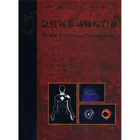 急性冠状动脉综合征