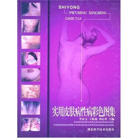 实用皮肤病性病彩色图集