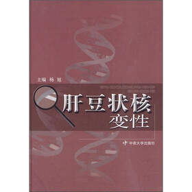 肝豆状核变性