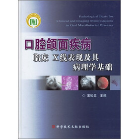 口腔颌面疾病临床X线表现及其病理学基础