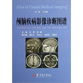 颅脑疾病影像诊断图谱
