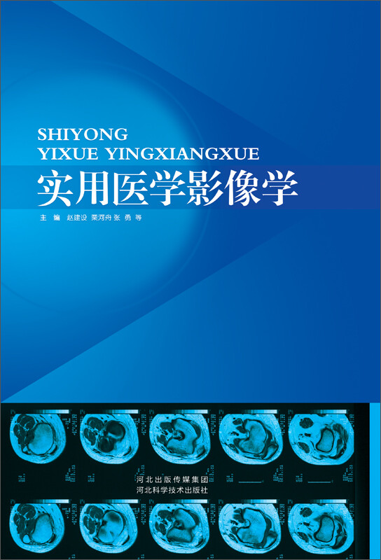 二系放射学教研室赵建农 医学影像技术学和医学影像学有什么区别吗?