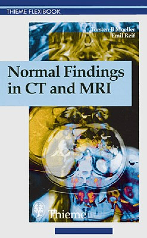 【预订】normal findings in ct and mri