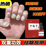 久木堂甲郎中灰指甲液草本精油护甲液增厚变色抑菌液灰指甲三味草灰
