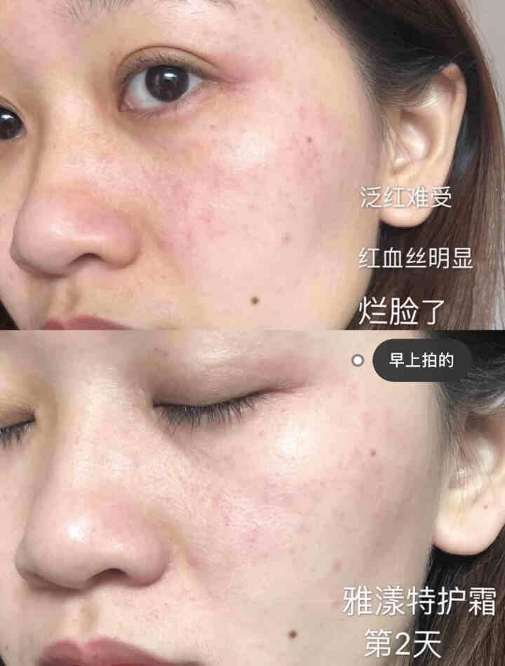 雅漾（Avene）雅漾舒缓特护保湿霜 5ML怎么样，好用吗，口碑，心得，评价，试用报告,第3张