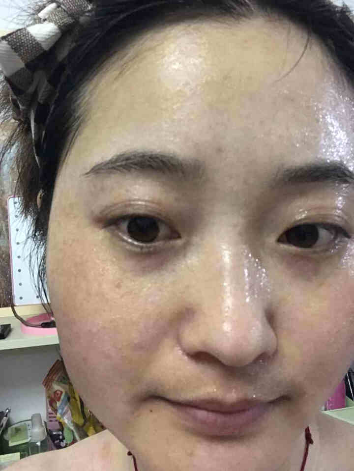 蝶颜诗医用面膜无菌医美护肤品敏感肌皮炎微针水光针激光术后修复舒缓急救补水类人胶原蛋白冷敷贴去红血丝 1片装（试用）怎么样，好用吗，口碑，心得，评价，试用报告,第6张