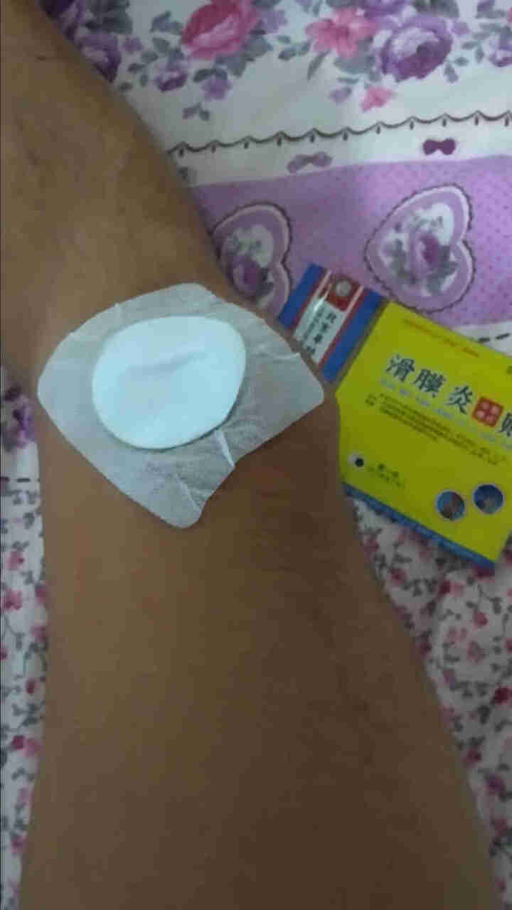 苗霸滑膜炎膏药贴膏关节积水积液专用消肿膝盖疼痛贴