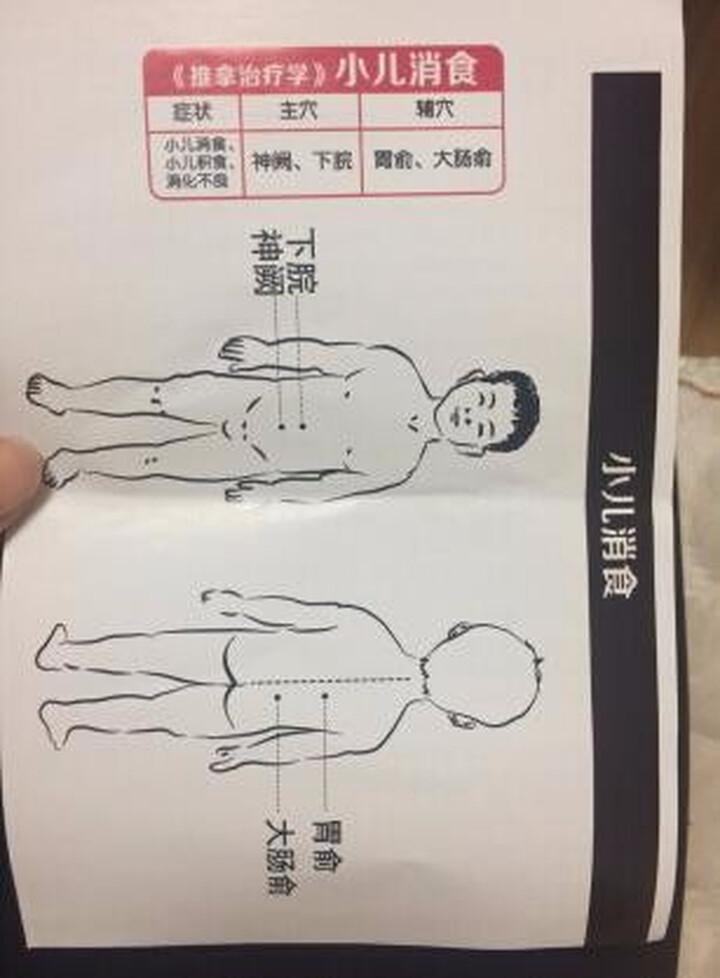 皇圣堂琼森穴位贴敷治疗贴 儿童小孩膏药 8贴/盒 小儿