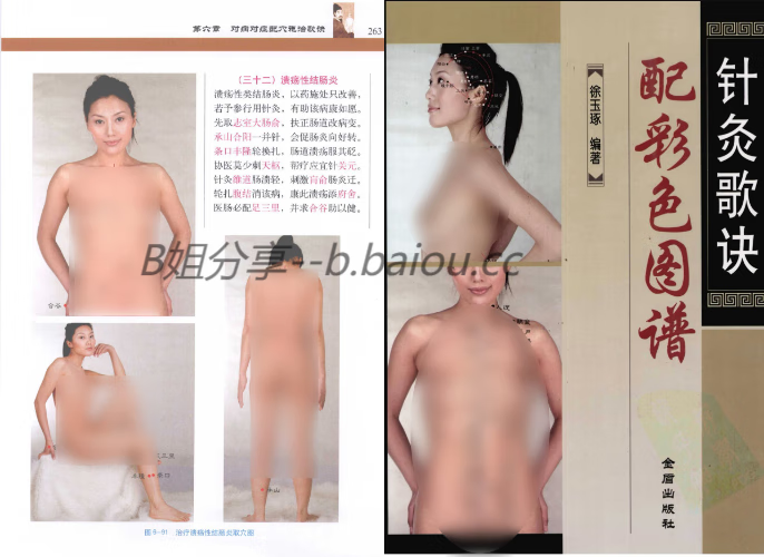 针灸歌诀配彩色图谱--真人插画