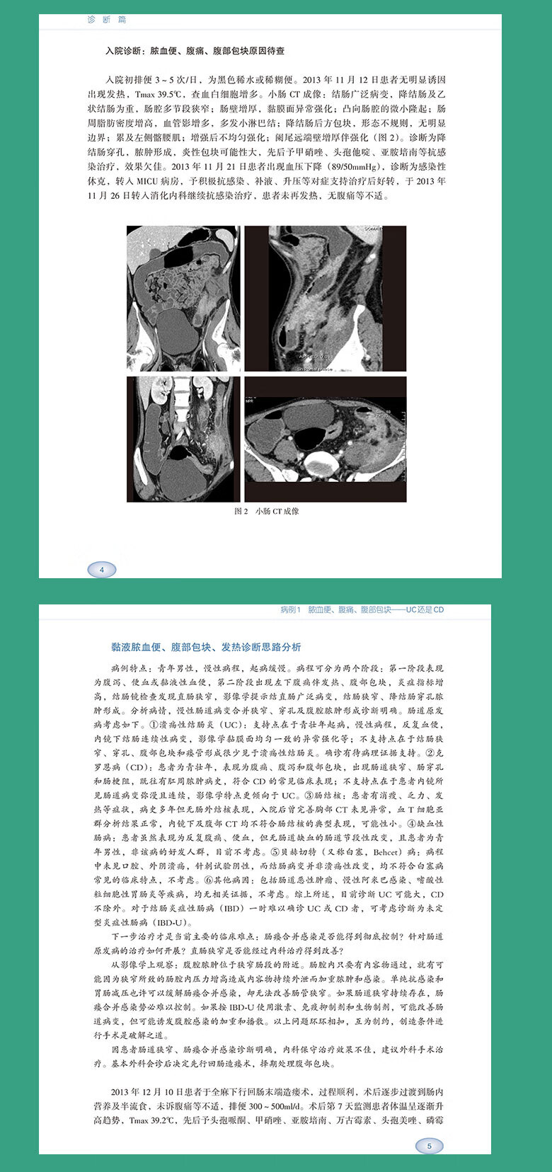 现货北京协和医院肠病疑难病例剖析120例肠疾病疑难病病案分析临床