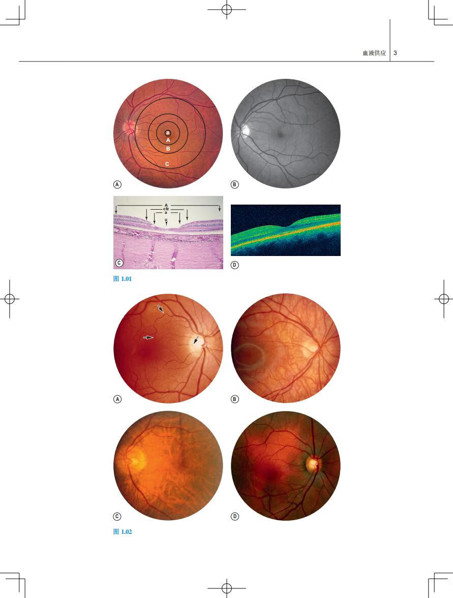正版gass黄斑病学图谱 孙晓东 眼科学书籍 阐述各类黄斑疾病诊断鉴别