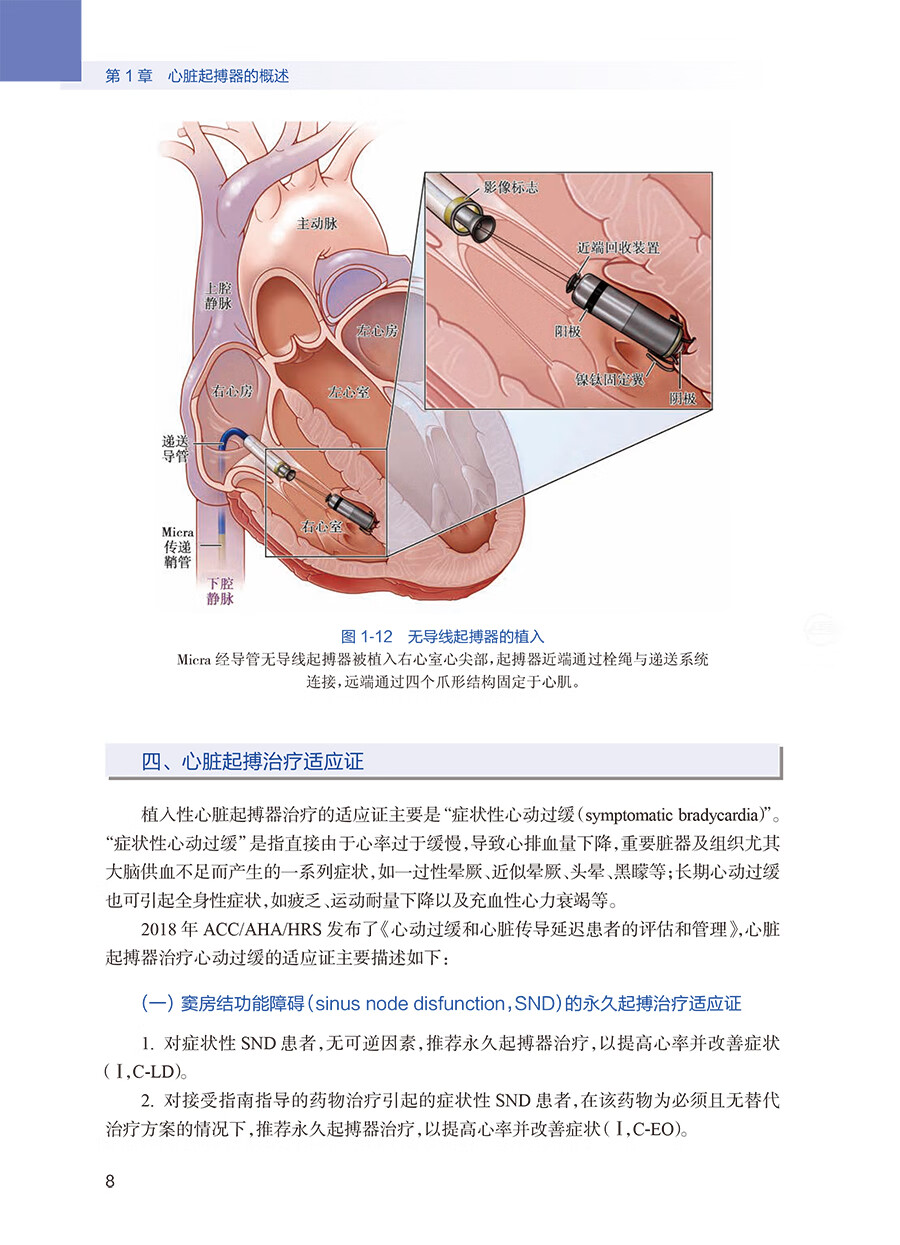 心脏起搏器随访与程控人民卫生出版社陈柯萍张澍9787117301732