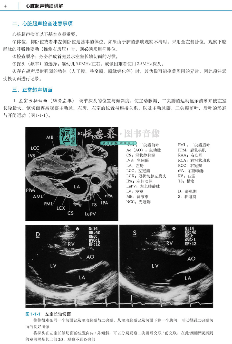 心脏超声精细讲解 中村宪司 切面解剖扫查方法与疾病解读心脏超声入门