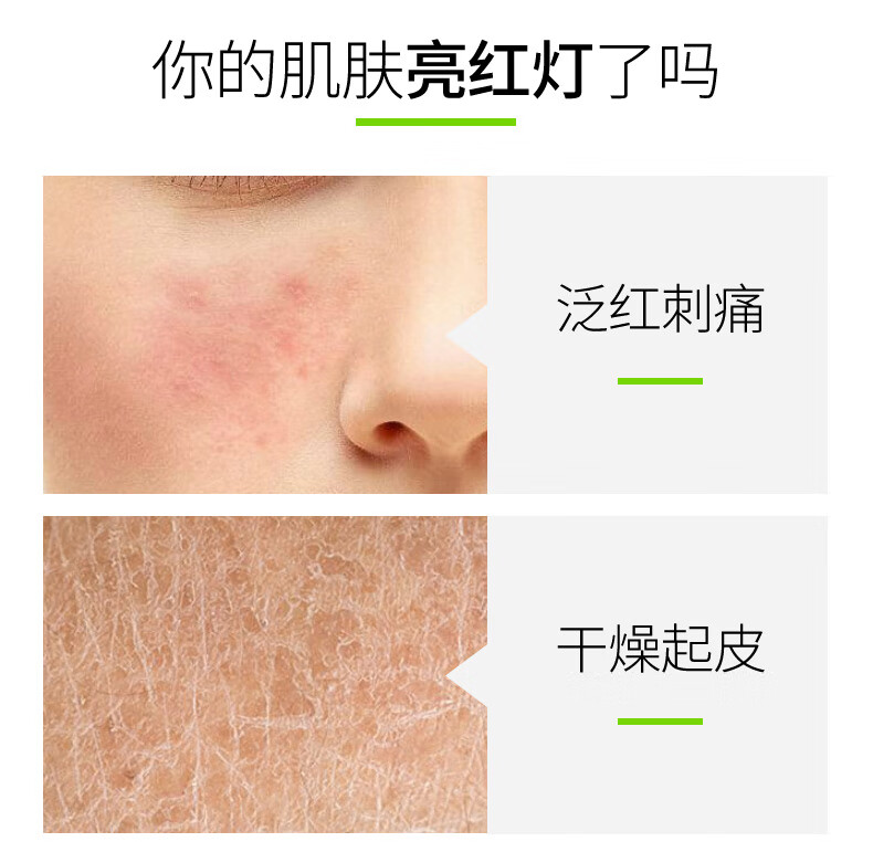 芦荟胶40g详情新750-2_03.jpg