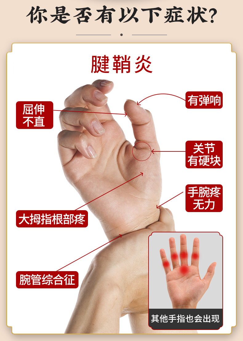 手指关节炎热敷图图片