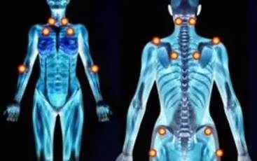 什么是腰背肌筋膜炎 有这4种临床症状的人要注意了 概述 病因 药物治疗 手术治疗