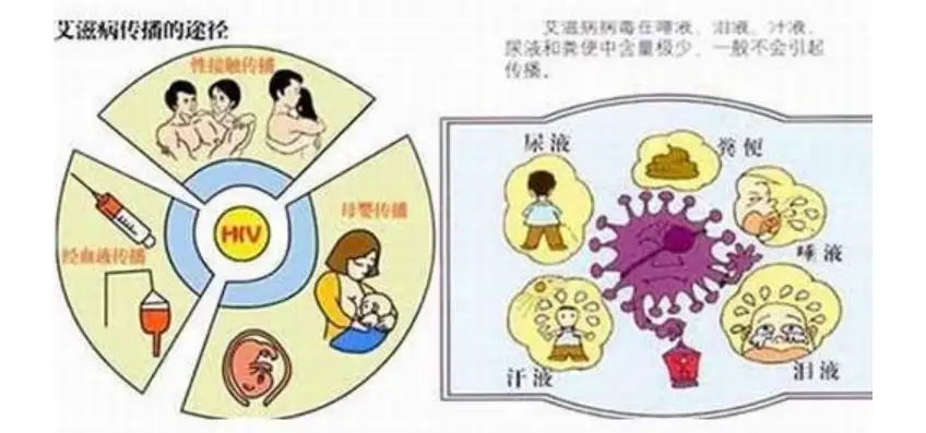 在医院血检查出hiv阳性 真的就是得了艾滋吗 传染病 饮食 概述 预防