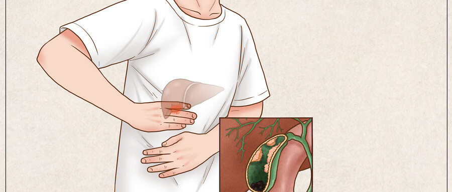 胆囊息肉样改变是什么意思 检查 日常护理 消化内科