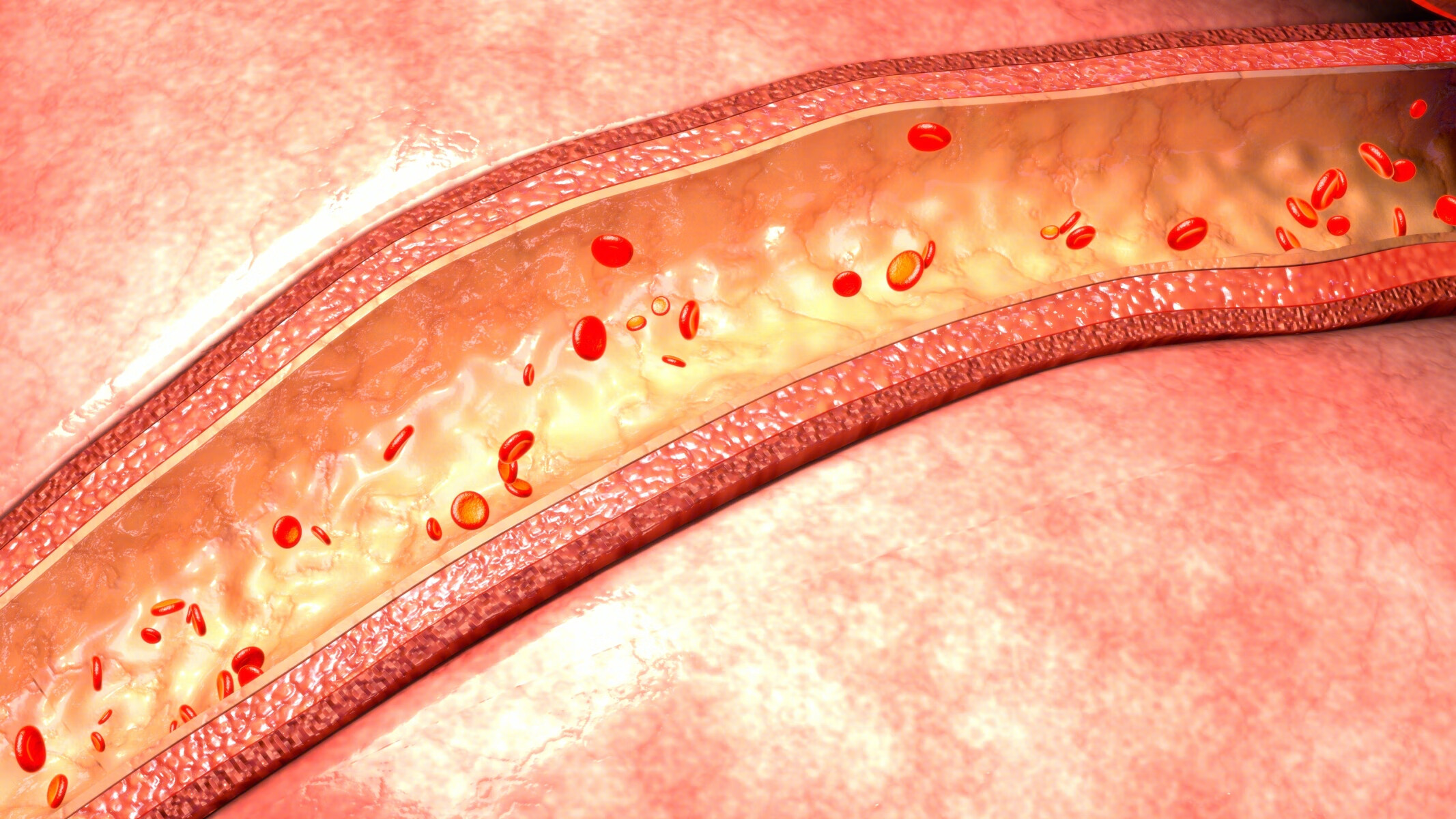 高血压患者在春季应该如何饮食?_心血管_营养_养生