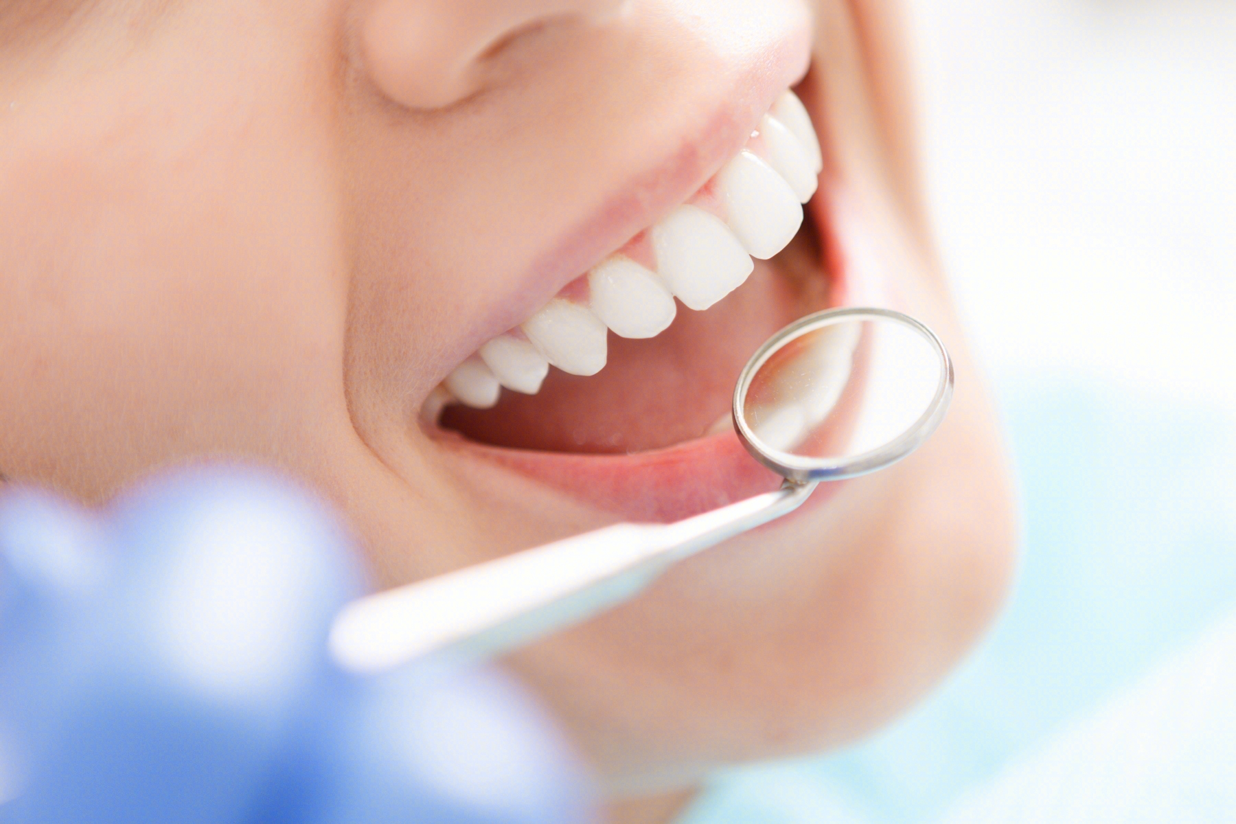 频繁洗牙到底可不可取 对牙齿的伤害有多大 日常护理 口腔