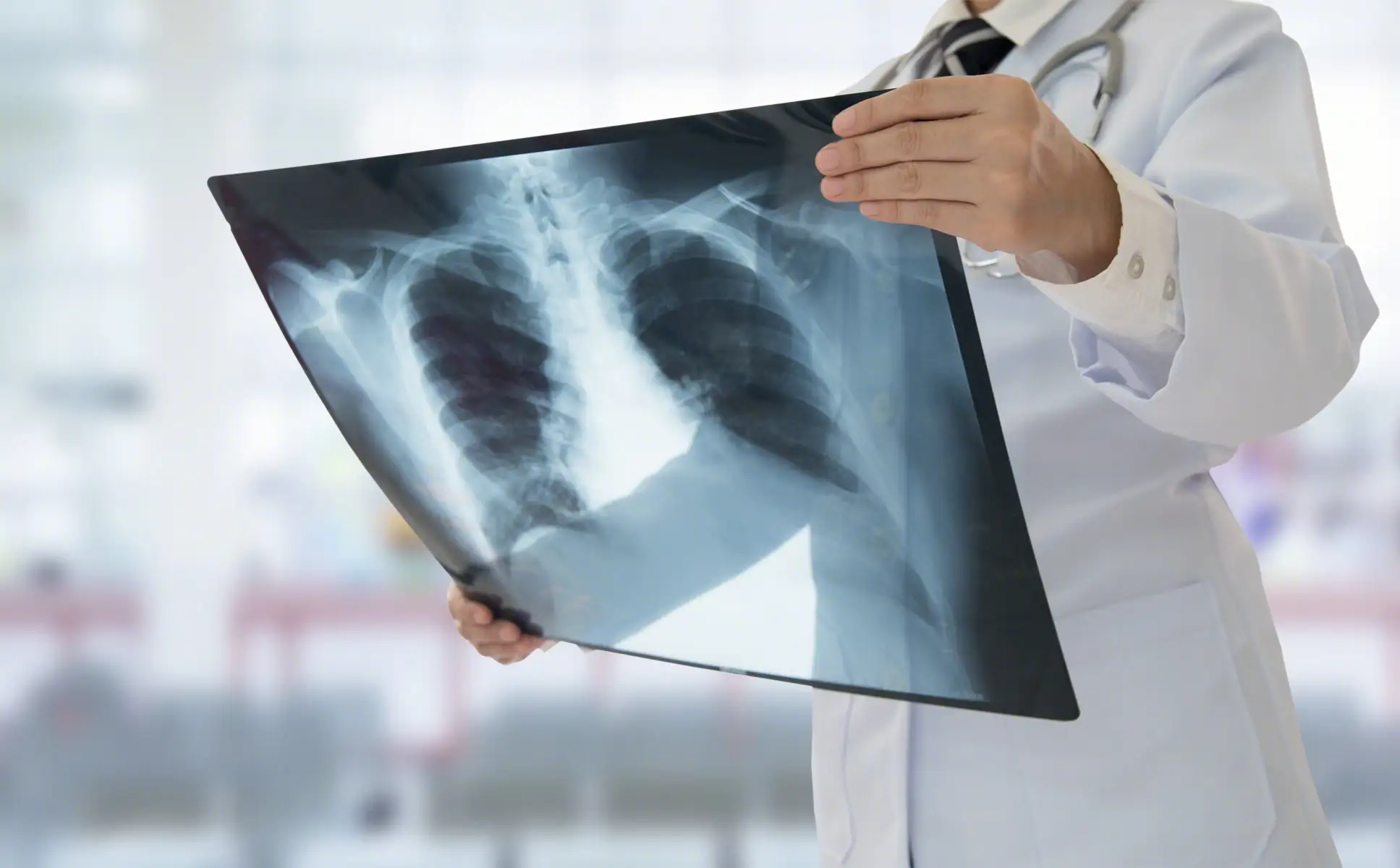 左胸出现轻微的隐痛是怎么回事 男性健康 女性健康 概述 预防 检查